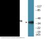 MKK6 (Phospho-Ser207) Colorimetric Cell-Based ELISA Kit