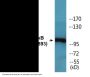 NF-kappaB p105/p50 (Phospho-Ser893) Colorimetric Cell-Based ELISA Kit