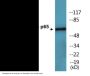 NF-kappaB p65 (Phospho-Ser276) Colorimetric Cell-Based ELISA Kit