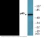NF-kappaB p65 (Phospho-Ser468) Colorimetric Cell-Based ELISA Kit