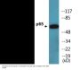 NF-kappaB p65 (Phospho-Thr254) Colorimetric Cell-Based ELISA Kit