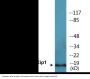 p21 Cip1 (Phospho-Thr145) Colorimetric Cell-Based ELISA Kit