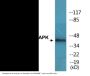 p38 MAPK (Phospho-Tyr182) Colorimetric Cell-Based ELISA Kit