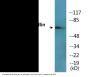 Paxillin (Phospho-Tyr118) Colorimetric Cell-Based ELISA Kit