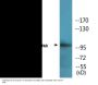 Retinoblastoma (Phospho-Ser795) Colorimetric Cell-Based ELISA Kit