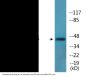 SEK1/MKK4 (Phospho-Ser80) Colorimetric Cell-Based ELISA Kit