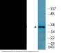 SEK1/MKK4 (Phospho-Thr261) Colorimetric Cell-Based ELISA Kit