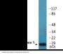 Stathmin 1 (Phospho-Ser15) Colorimetric Cell-Based ELISA Kit