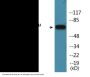 Tau (Phospho-Ser422) Colorimetric Cell-Based ELISA Kit