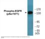 EGFR (Phospho-Ser1071) Colorimetric Cell-Based ELISA Kit
