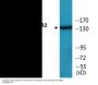 HER2 (Phospho-Tyr1112) Colorimetric Cell-Based ELISA Kit