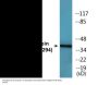 Casein Kinase I alpha (Phospho-Tyr294) Colorimetric Cell-Based ELISA Kit