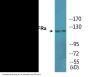 PDGFRa (Phospho-Tyr849) Colorimetric Cell-Based ELISA Kit