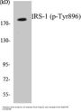 IRS-1 (Phospho-Tyr896) Colorimetric Cell-Based ELISA Kit