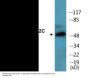 MEF2C (Phospho-Ser396) Colorimetric Cell-Based ELISA Kit