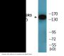 HER3 (Phospho-Tyr1197) Colorimetric Cell-Based ELISA Kit