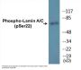 Lamin A/C (Phospho-Ser22) Colorimetric Cell-Based ELISA Kit