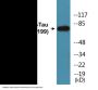 Tau (Phospho-Ser516/199) Colorimetric Cell-Based ELISA Kit