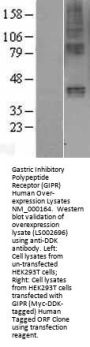 Gastric Inhibitory Polypeptide Receptor (GIPR) (NM_000164) Human Over-expression Lysate