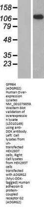 GPR64 (ADGRG2) (NM_001079859) Human Over-expression Lysate