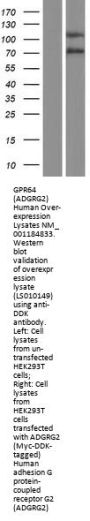 GPR64 (ADGRG2) (NM_001079859) Human Over-expression Lysate