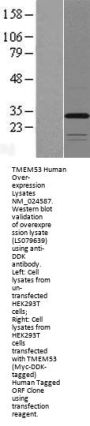 TMEM53 (NM_024587) Human Over-expression Lysate