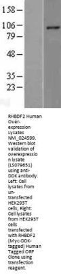RHBDF2 (NM_024599) Human Over-expression Lysate