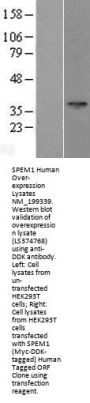 SPEM1 (NM_199339) Human Over-expression Lysate