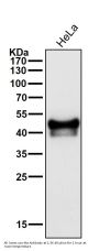 Anti-p53 TP53 Rabbit Monoclonal Antibody