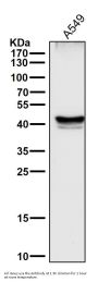 Anti-p53 TP53 Rabbit Monoclonal Antibody