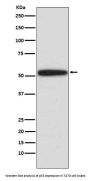 Anti-p53 TP53 Rabbit Monoclonal Antibody