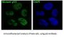 Anti-p53 TP53 Rabbit Monoclonal Antibody