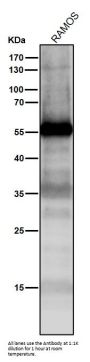 Anti-p53 TP53 Rabbit Monoclonal Antibody