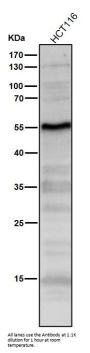Anti-p53 TP53 Rabbit Monoclonal Antibody