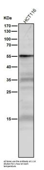 Anti-p53 TP53 Rabbit Monoclonal Antibody