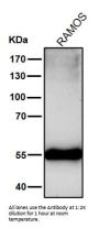 Anti-Mutant p53 Rabbit Monoclonal Antibody