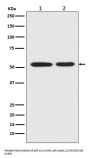 Anti-Mutant p53 Rabbit Monoclonal Antibody