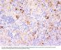Anti-TNF-alpha (Tumor Necrosis Factor alpha) Monoclonal Antibody