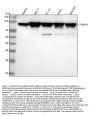 Anti-beta Catenin CTNNB1 Rabbit Monoclonal Antibody
