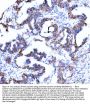 Anti-beta Catenin CTNNB1 Rabbit Monoclonal Antibody