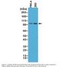 Anti-Beta-Catenin 1 (CTNNB1) Rabbit Monoclonal Antibody, Clone#RM276