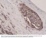 Anti-Beta-Catenin 1 (CTNNB1) Rabbit Monoclonal Antibody, Clone#RM276