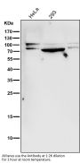Anti-STAT3 Rabbit Monoclonal Antibody