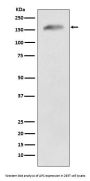 Anti-APC Monoclonal Antibody