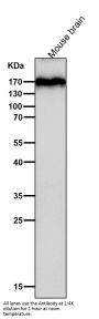 Anti-APC Monoclonal Antibody