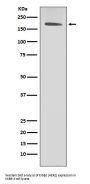 Anti-ErbB2 (HER2) Monoclonal Antibody