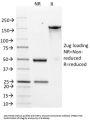 Anti-HER-2 / c-erbB-2 / neu / CD340 Monoclonal Antibody