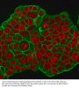 Anti-HER-2 / c-erbB-2 / neu / CD340 Monoclonal Antibody