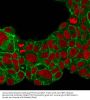Anti-HER-2 / c-erbB-2 / neu / CD340 Monoclonal Antibody
