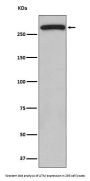 Anti-ATM Monoclonal Antibody